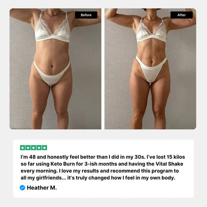 Keto Burn+ Gummies Deal