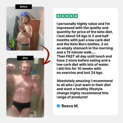 Keto Burn+ Gummies Deal